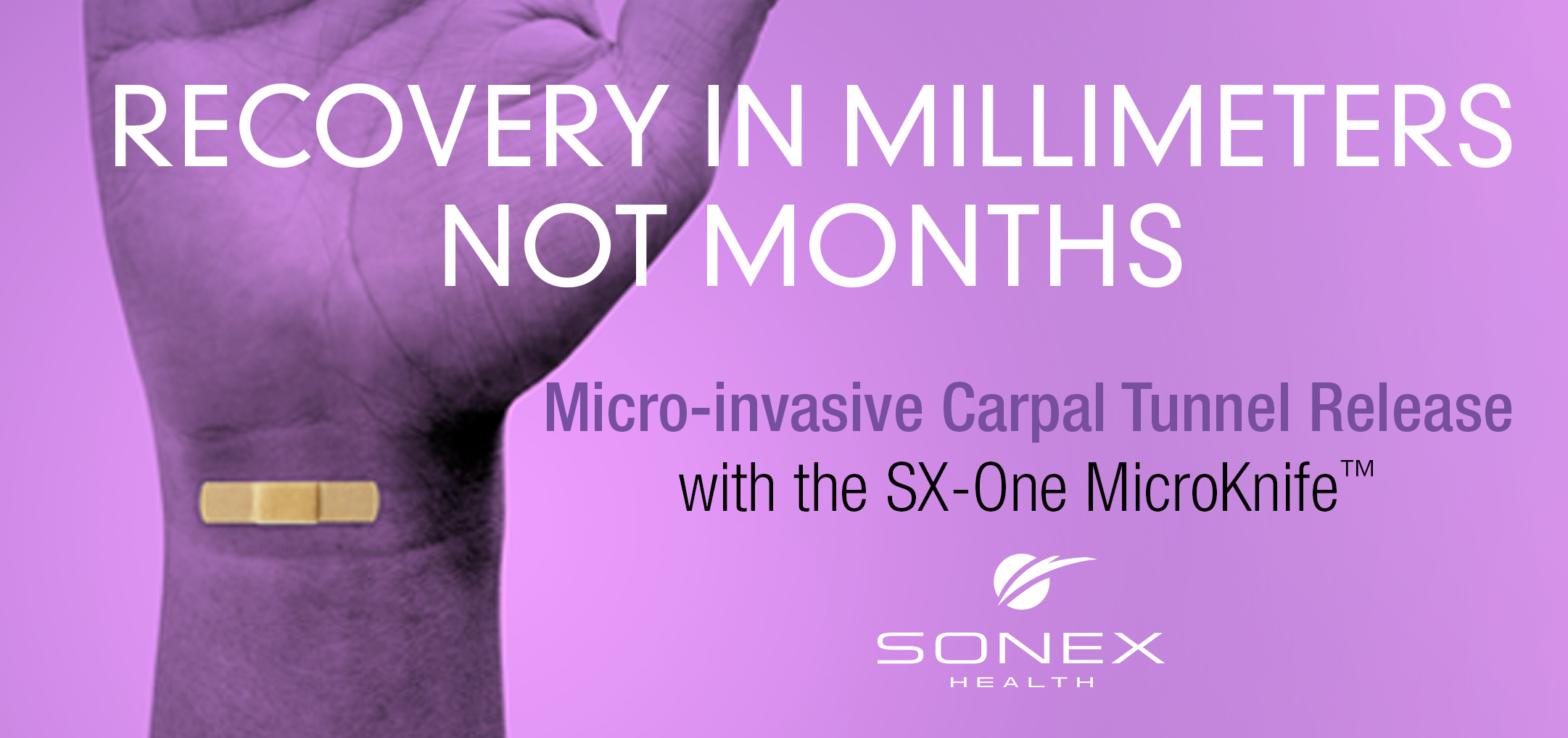 Sonex Health micro-invasive carpel tunnel release - medical device marketing materials